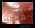 small colonies of Streptococcus pneumoniae with depresses centers